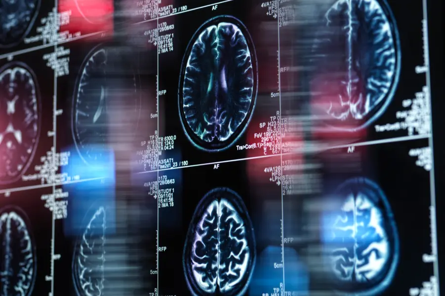 A collection of brain scans is displayed on a backlit wall.